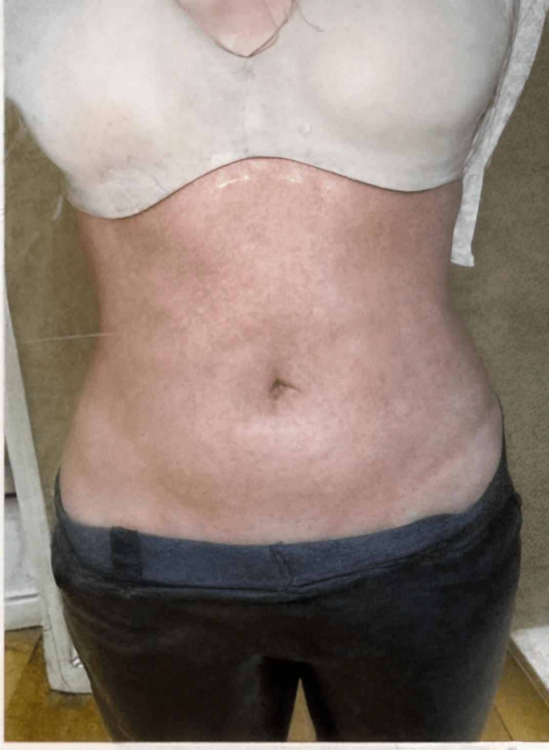 After treatment