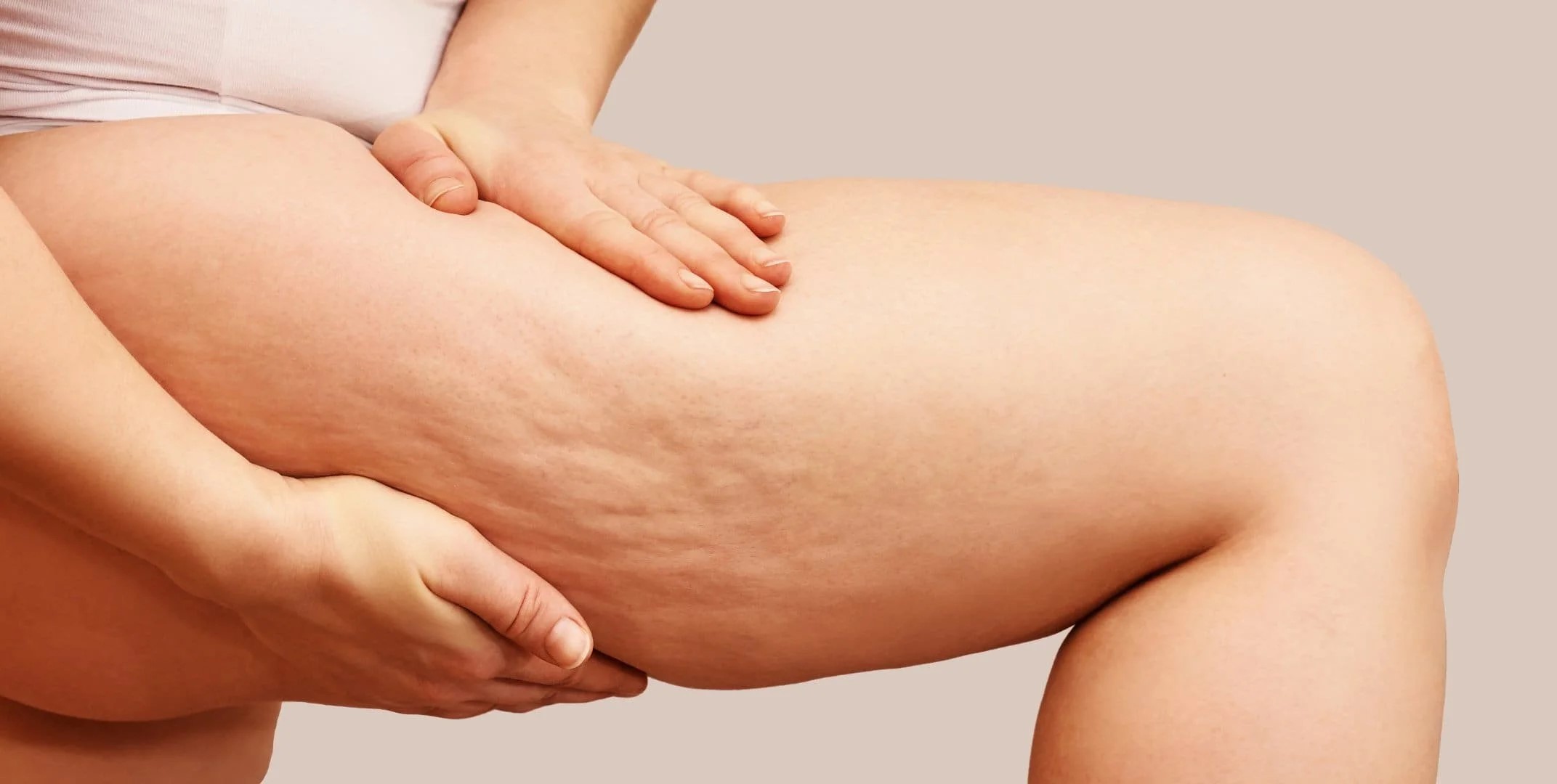 Fat freezing thighs treatment process Melbourne clinic