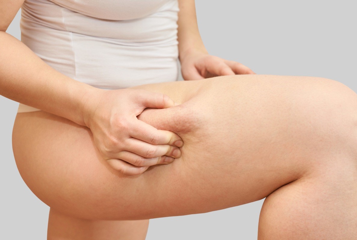 Fat freezing thighs inner outer treatment Melbourne